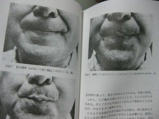 音域を拡げるについて