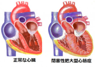 コロナ禍と持病について
