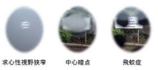 アセスメント29